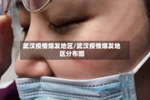 武汉疫情爆发地区/武汉疫情爆发地区分布图