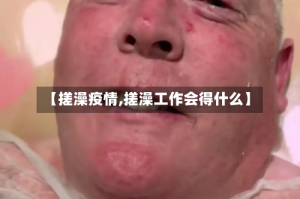 【搓澡疫情,搓澡工作会得什么】