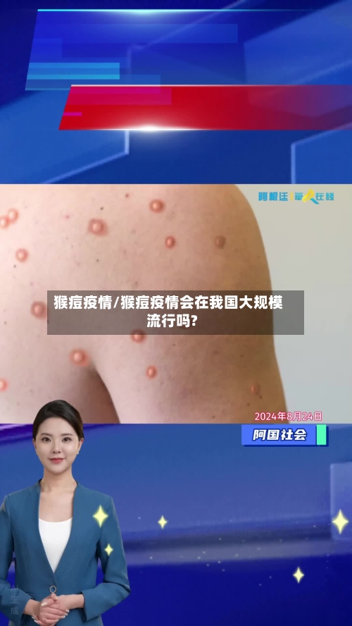 猴痘疫情/猴痘疫情会在我国大规模流行吗?-第2张图片