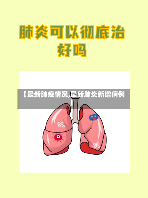 【最新肺疫情况,最新肺炎新增病例】-第1张图片