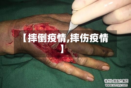 【摔倒疫情,摔伤疫情】-第3张图片