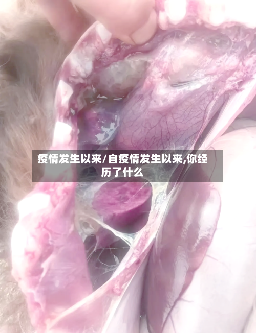 疫情发生以来/自疫情发生以来,你经历了什么-第1张图片